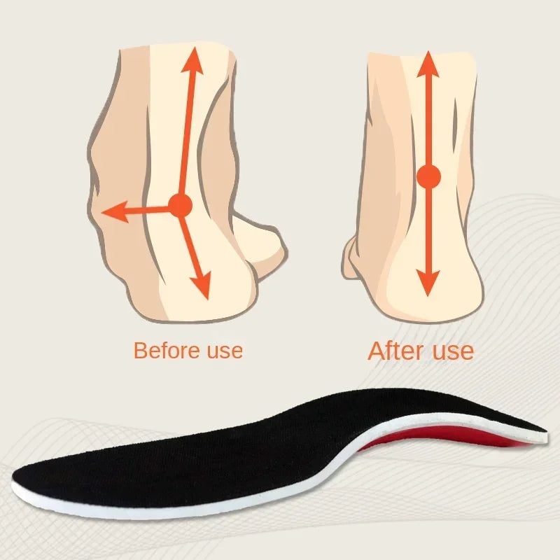 Orthotic Insole Arch Support Flatfoot Orthopedic Insoles Arch Support Flat Feet for Women / Men Orthopedic Plantar Foot Pain